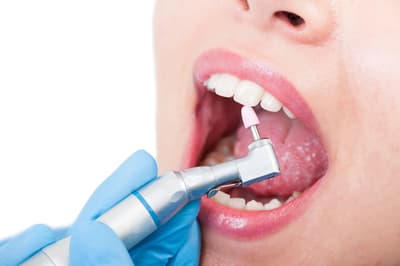 Figura illustrativa 32 Cliniche Dentali