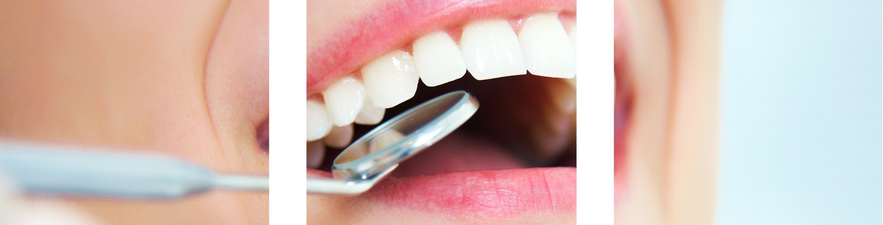 Figura illustrativa Clinica Dentale Tortonese S.r.l.