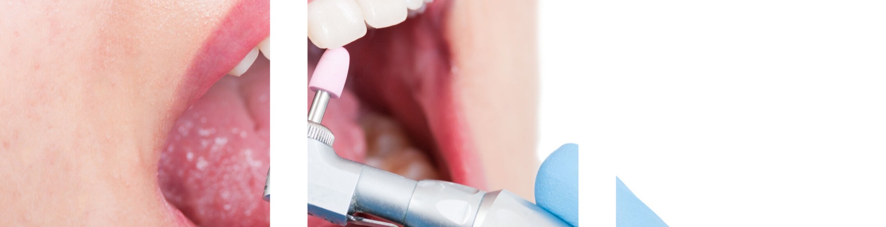 Figura illustrativa Clinica Dentale Tortonese S.r.l.