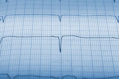 Figura illustrativa C-Spin Ingegneri Associati