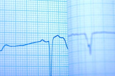 Figura illustrativa C-Spin Ingegneri Associati