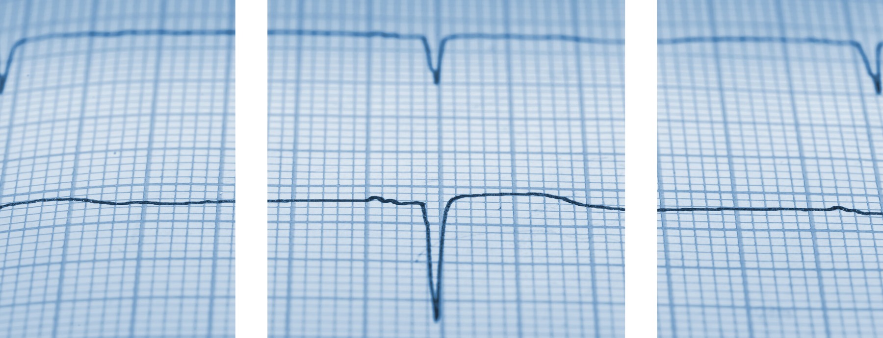 Figura illustrativa C-Spin Ingegneri Associati