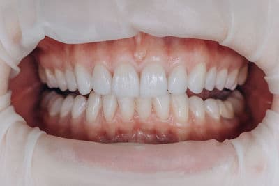 Figura illustrativa Centro Dentistico di Gustinetti Andrea & C.